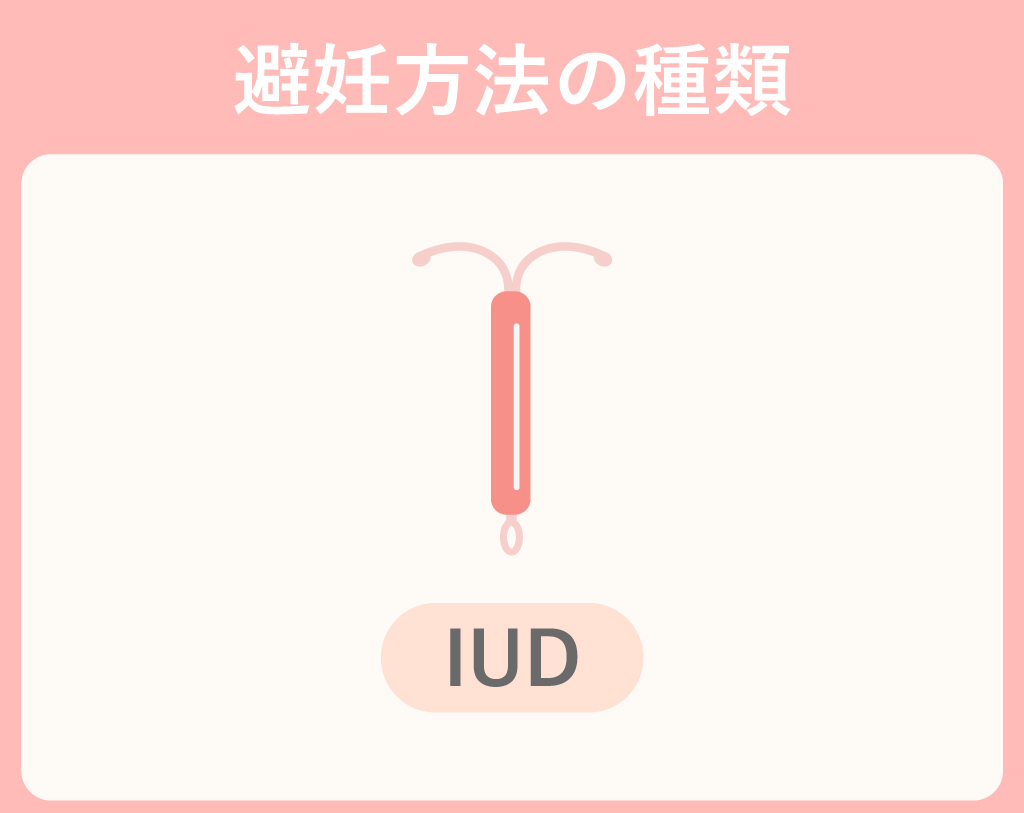IUD（子宮内避妊器具）