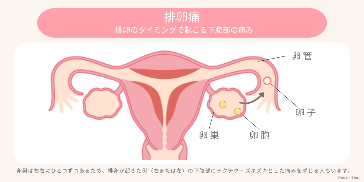 排卵痛が起こる仕組みの図