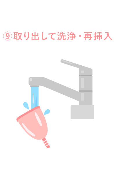 取り出して洗浄・再挿入