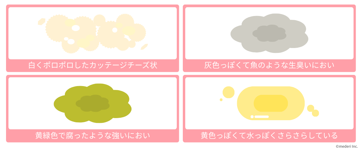 おりもの_病気の可能性があるもの