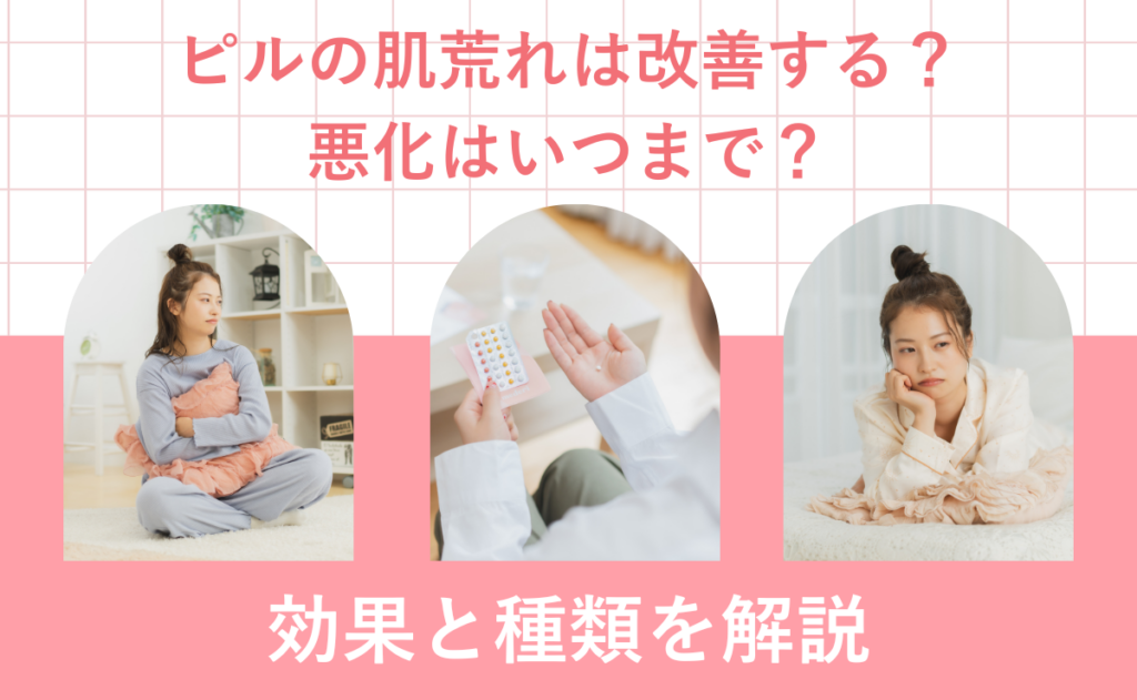 ピルの肌荒れは改善する？悪化はいつまで？効果と種類を解説