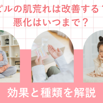 ピルの肌荒れは改善する？悪化はいつまで？効果と種類を解説