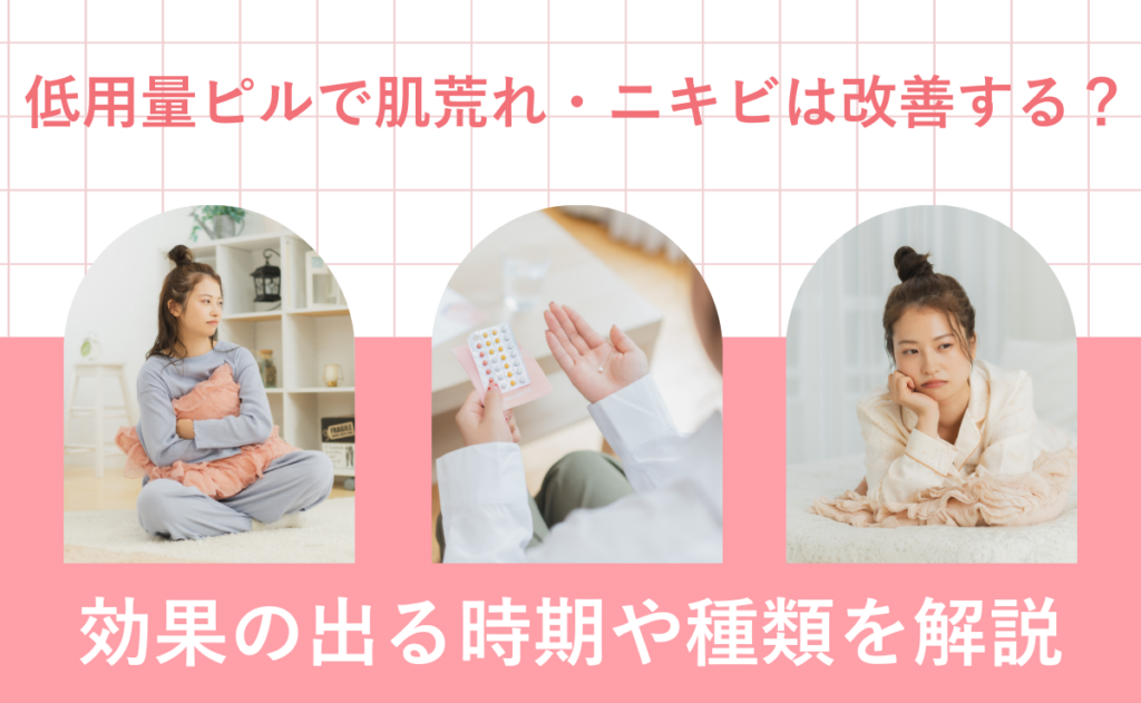 低用量ピルで肌荒れ・ニキビは改善する？効果の出る時期や種類を解説